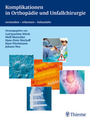 cover image of Komplikationen in Orthopädie und Unfallchirurgie